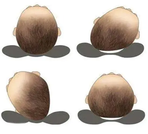 Momease Baby Cotton Soft Head Shaper Anti Flat Pillow With Mustard Seeds